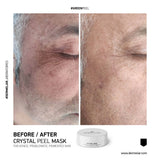 Dermelar Crystal Peel Starter Kit
