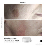Dermelar Crystal Peel Starter Kit