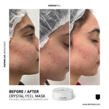 Dermelar Crystal Peel Starter Kit