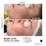 Dermelar Crystal Peel Starter Kit