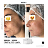 Dermelar Crystal Peel Kit 6pcs - MasksńMore
