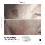 Dermelar Crystal Peel Kit 6pcs - MasksńMore