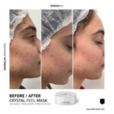 Dermelar Crystal Peel Kit 6pcs - MasksńMore