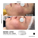 Dermelar Crystal Peel Kit 6pcs - MasksńMore