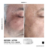 Dermelar Crystal Peel Kit 6pcs - MasksńMore