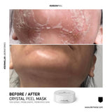 Dermelar Crystal Peel Kit 6pcs - MasksńMore