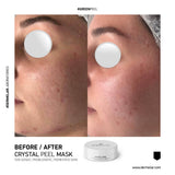 Dermelar Crystal Peel Kit 6pcs - MasksńMore