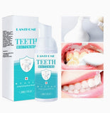 Teeth Whitening Foam - MasksńMore