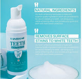 Teeth Whitening Foam - MasksńMore