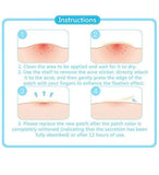 Acne Patches 20 pcs - MasksńMore