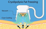 Cryolipolysis Fat Lipolysis Fat Freeze Machine
