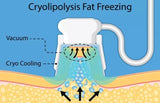 Cryolipolysis Fat Lipolysis Fat Freeze Machine - MasksńMore