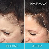 LED Cap PhotoTherapy Hat for Hair Growth - MasksńMore