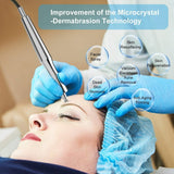 Microdermabrasion Diamond Peeling Machine - MasksńMore