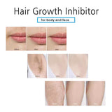 Natural Hair Growth Inhibitor Spray (Face + Body) - MasksńMore