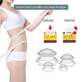 Silicone Vacuum Cupping Massage Therapy Set - 4pcs - MasksńMore