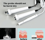 Ultrasonic Skin Tag RF Machine 3 in 1 - MasksńMore